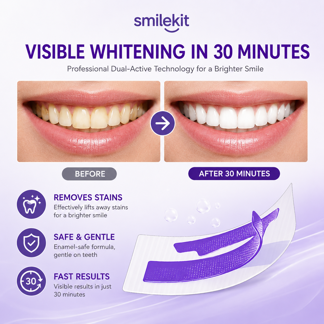 Smilekit Purple Teeth Whitening Strips (7 pairs of 14 stickers)